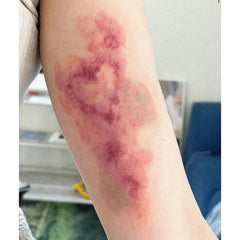 YICKYUE  -  Heart Bruise Fake Tattoo for Woman Man Arm Art Scar Blood Stasis Temporary Tattoos Waterproof Tatuajes Temporales Cosplay